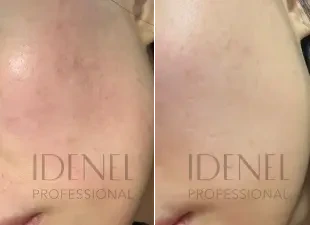 Après 6 semaines d'utilisation